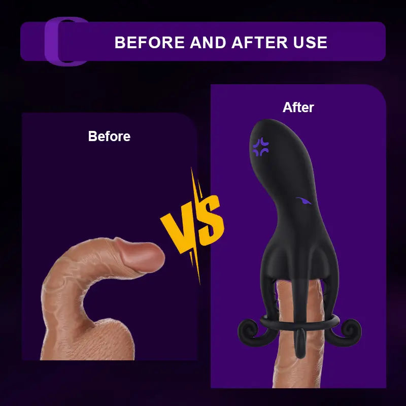 XG11: Stimulateur de Gland Octopus avec 10 Modes de Vibration